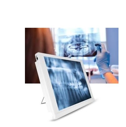 چراغ نگاتوسکوپ و نگاتوسکوپ دندانپزشکی چیست؟