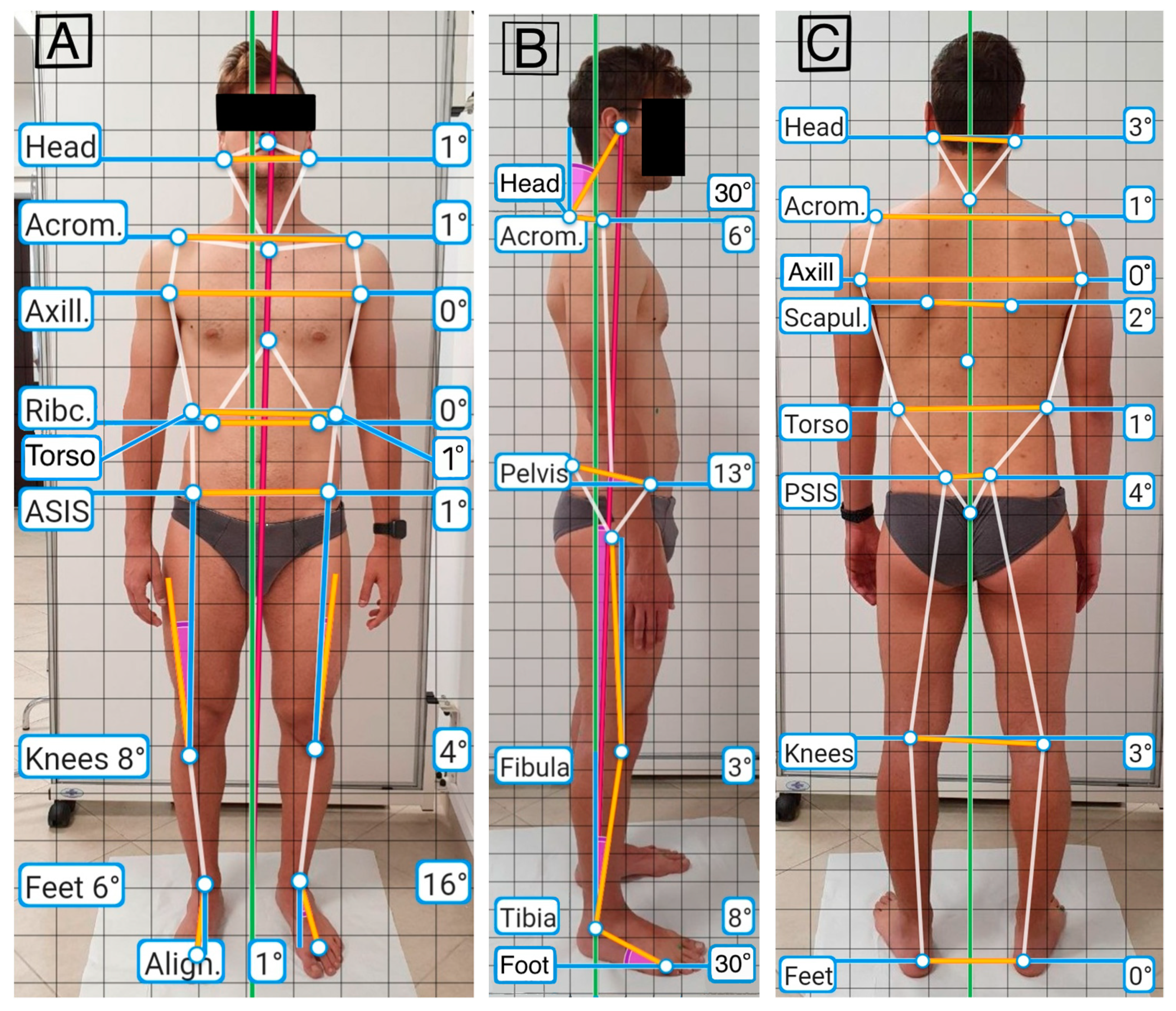 آنالیز پاسچر چیست؟ بررسی مهندسی بدن در عصر هوش مصنوعی