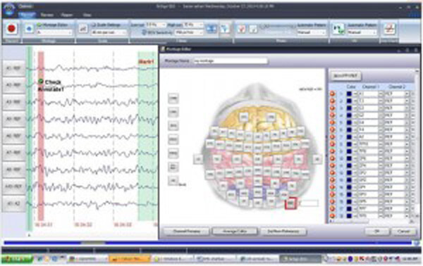 دستگاه EEG مدل Portable 3840 | می مد