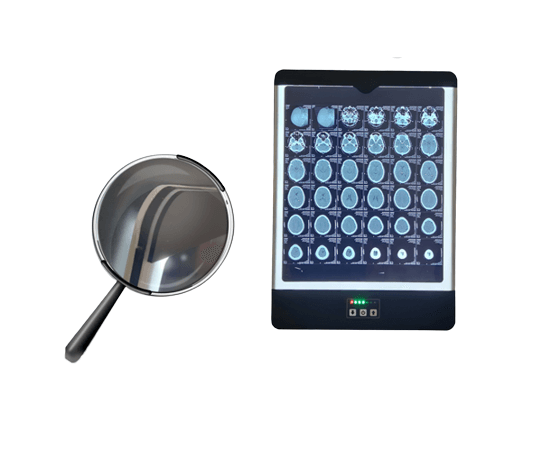 نگاتوسکوپ پزشکی دندانپزشکی مون لایت مدل دیواری و رومیزی 1,2,3 خانه LED
