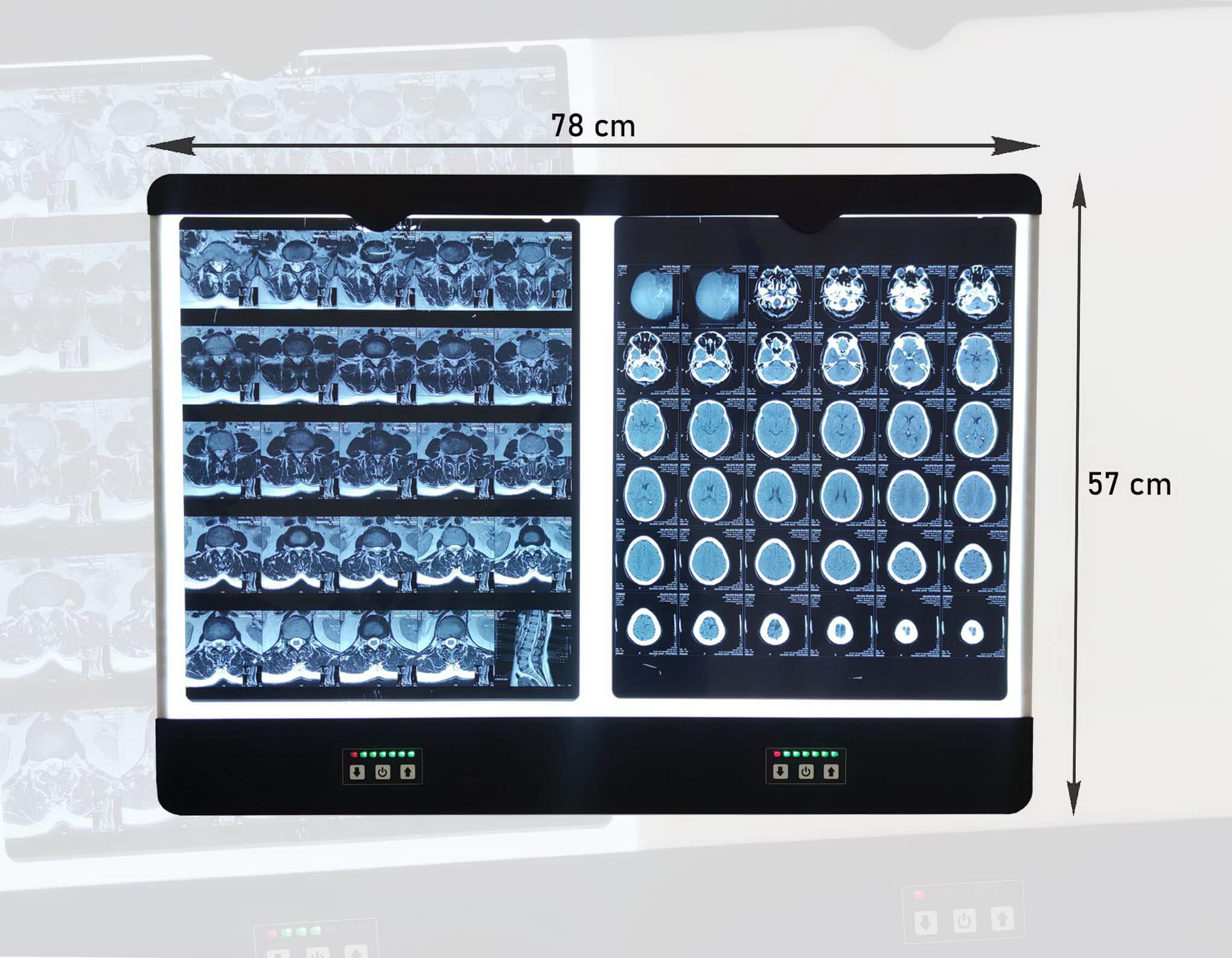 نگاتوسکوپ پزشکی دندانپزشکی مون لایت مدل دیواری و رومیزی 1,2,3 خانه LED | می مد