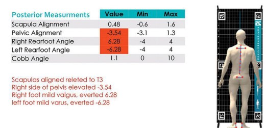 دستگاه آنالیز قامت (پاسچر گرافی) مدل PT-POSTURE | می مد