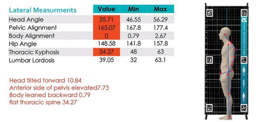 دستگاه آنالیز قامت (پاسچر گرافی) مدل PT-POSTURE | می مد