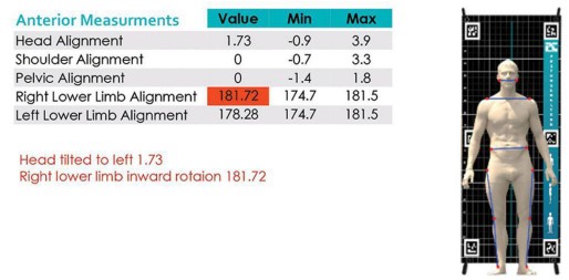 دستگاه آنالیز قامت (پاسچر گرافی) مدل PT-POSTURE | می مد
