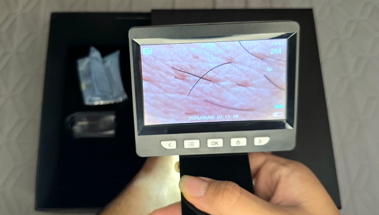 درماتوسکوپ دیجیتال ایرانی مای Mai | می مد