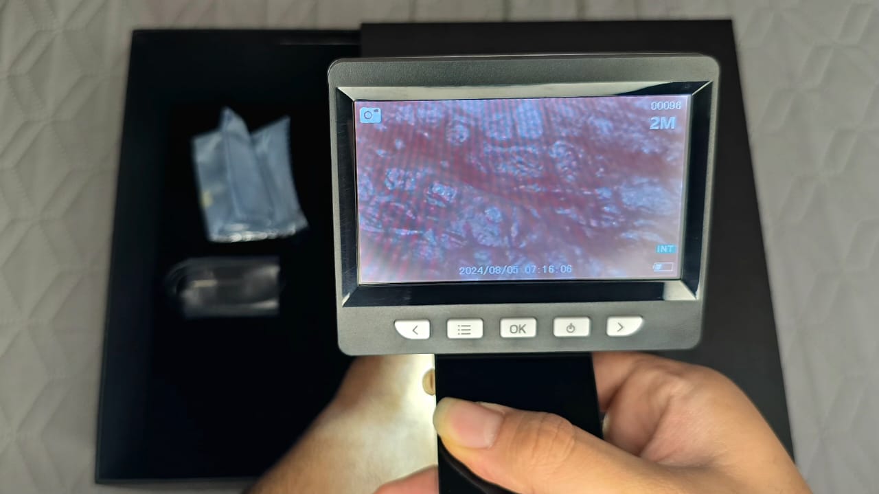 درماتوسکوپ دیجیتال ایرانی مای Mai | می مد